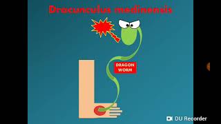 Dracunculus medinensis Dracontiasis الدودة التنين [upl. by Kammerer]