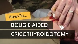 Bougie Aided Cricothyroidotomy [upl. by Hsac]