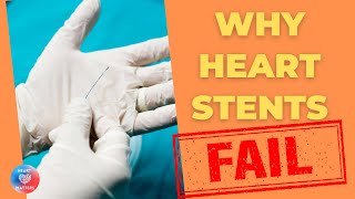 WHY heart stents FAIL [upl. by Shrier]