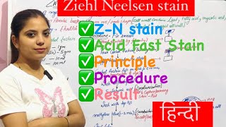 Ziehl Neelsen Stain ॥ ZN Stain ॥Acid Fast Staining ॥ZN Stain ॥Microbiology ॥principle ॥ procedure [upl. by Colvert]