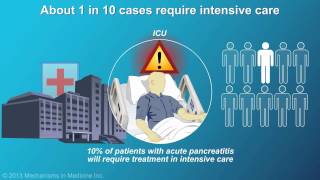 Management and Treatment of Acute Pancreatitis [upl. by Niuqaoj]