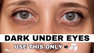 Remove dark under eye circles in just 1 WEEK  Sustainable lifestyle tip 1 [upl. by Jaddo]