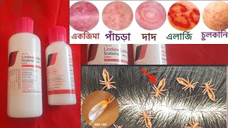 Lindane Lotion U S P  চুলকানি পাচডা ইতাদি বাংলা [upl. by Lajib]