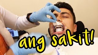 I Tried Professional Teeth Whitening 100 Effective [upl. by Sula]