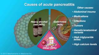 Acute Pancreatitis [upl. by Annohsal770]