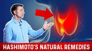 Best Nutrients For Hashimotos Thyroiditis – Dr Berg [upl. by Acalia]