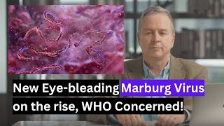 Marburg Virus on the risa [upl. by Turrell546]