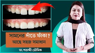 সামনের দাঁতে ফাঁকা  Gap Between Front teeth  Dr Shatabdi Bhowmik  Bangla [upl. by Carrel]