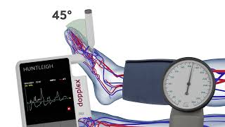 How to Measure the Systolic Pressure of the Dorsalis Pedis when Performing an ABPI [upl. by Eruot]