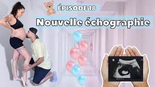 ÉPISODE 18  NOUVELLE ÉCHOGRAPHIE  PRÉPARATION quotGENDER REVEALquot [upl. by Shira]