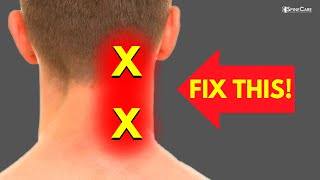 How to Fix Neck Pain off to the Side [upl. by Eintruoc904]