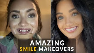 6 Shocking Cosmetic Smile Makeovers Designed WITHOUT A Dentist [upl. by Cleti]