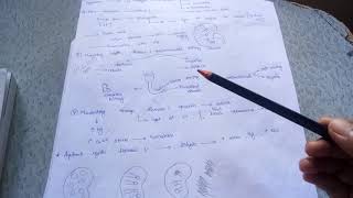 PATHOLOGY OF KIDNEYMEDULLARY CYSTIC DISEASEMEDULLARY SPONGE DISEASE⚡ [upl. by Enrol]