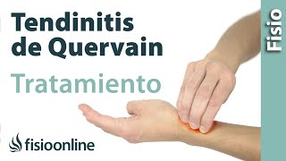 Tendinitis de De Quervain  Tratamiento con ejercicios automasajes y estiramientos [upl. by Avaria]