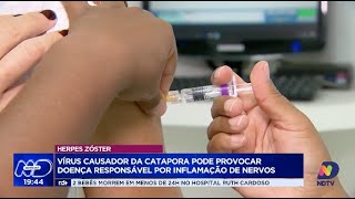 Herpes zóster vírus causador da catapora pode provocar doença responsável por inflamação de nervos [upl. by Fay]