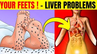 12 Shocking Signs Your Feet Reveal About Liver Problems  HealthQuest [upl. by Zetra]