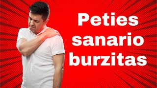 Peties sanario burzitas Kas tai kaip gydyti Kineziterapijos pratimai [upl. by Atikehs]