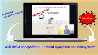 AntiNmethylDaspartate AntiNMDA Receptor Encephalitis Brain on Fire – A Synopsis [upl. by Yar]