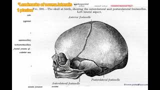 Pterion norma lateralis anatomy skull headandneckanatomy [upl. by Haletky]