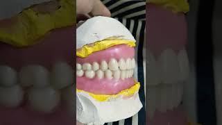 Teeth Arrangement Of upper Lower Complete Denture 😁😁😁completedentures fulldenture [upl. by Spracklen407]