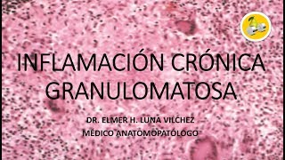 INFLAMACIÓN CRÓNICA GRANULOMATOSA  Dr Elmer Luna Vilchez [upl. by Jemmy129]