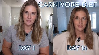 What I Eat for Weight Loss on a Carnivore Diet [upl. by Afrika]