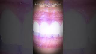 Dental Healing Frequency  Repair Teeth amp Gums  Teeth Regeneration Binaural Beats [upl. by Nalyd]