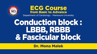 Conduction block  LBBB RBBB amp Fascicular block  Dr Mona Malek [upl. by Ennyl]