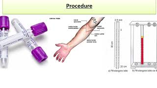 ESR  Erythrocyte sedimentation rate  Physio lab practical  urduhindi [upl. by Caritta]