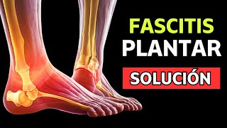 ⛔ Descubre Cómo ELIMINAR la FASCITIS PLANTAR en POCOS DÍAS  MÉTODO PROBADO ✅ [upl. by Ynnad]