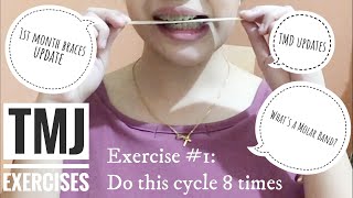 Vlog 6  1st month braces update  Molar Band  TMJ exercises  TMD treatment updates [upl. by Yeliak963]