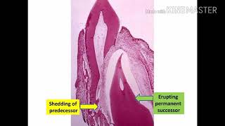 Spring 2018  Practical slides  eruption amp shedding amp TMJ [upl. by Agate]