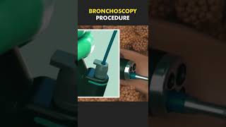 bronchoscopy procedure bscnursing ytshorts medicalstudent doctor lungs nursing [upl. by Namsu]