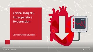 Critical Insights Intraoperative Hypotension [upl. by Wadesworth103]