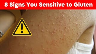 8 Signs You Might Be Sensitive to Gluten and Dont Know It [upl. by Annawt414]