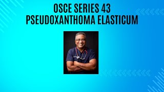 OSCE Series Episode 43  Pseudoxanthoma Elasticum [upl. by Aveneg]