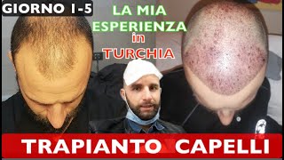 TRAPIANTO di CAPELLI In Turchia Ecco La mia Esperienza dellintervento [upl. by Akirdnwahs163]