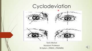 CYCLODEVIATIONS  INCYCLODEVIATION amp EXCYCLODEVIATION [upl. by Daas887]