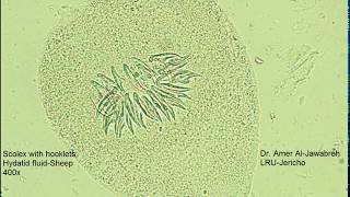 Hydatid fluid sheep protoscolex with hooklets [upl. by Ecidnarb]