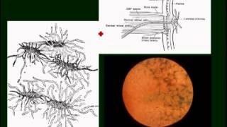 neuroophthalmology pt4 [upl. by Westfahl]