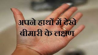 Symptoms of disease seen in your hands स्वास्थ्य रेखा हस्तरेखा शास्त्र  Palmistry gyan [upl. by Ronile]