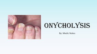 Onycholysis Plummers nail causes and pathophysiology [upl. by Yelroc]