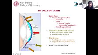 Scleral Lens Assessment and Fitting [upl. by Artemisa207]