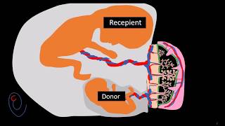 Twin to twin transfusion syndrome TTTS   part 1 pathogenesis [upl. by Eerolam]