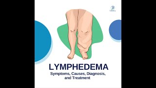 Lymphedema  Symptoms Causes Diagnosis and Treatment [upl. by Heyra]