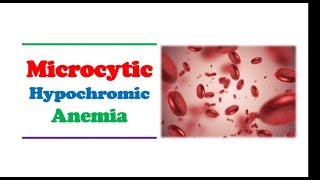 Hematology 🔤  Microcytic Hypochromic Anemia [upl. by Marta]