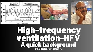 High frequency ventilation l A review of its background [upl. by Cazzie431]