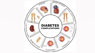 Complications of DM Uptodate simple as simple [upl. by Gentry]