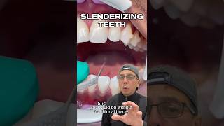 How Invisalign Can Fix Minimal Crowding of Teeth  View Mobile Dental shorts [upl. by Eram]