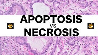 Apoptosis Intrinsic Extrinsic Pathways vs Necrosis [upl. by Ardnekahs]